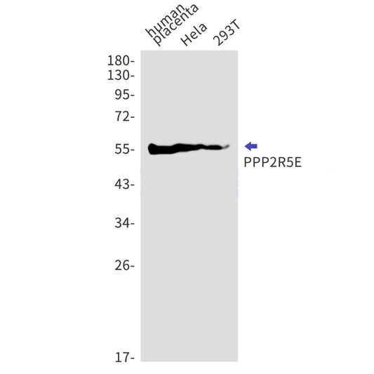 PPP2R5E (16A15) Rabbit Monoclonal Antibody