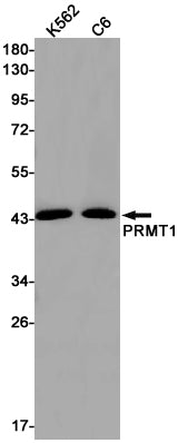 PRMT1 (2C19) Rabbit Monoclonal Antibody
