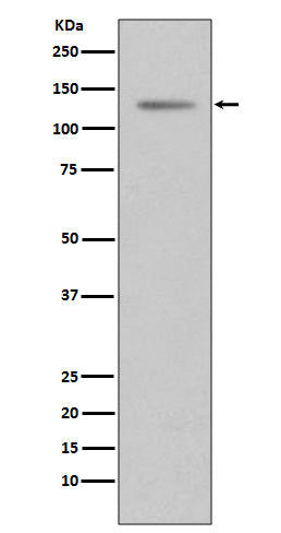 Progesterone Receptor (4V13) Rabbit Monoclonal Antibody