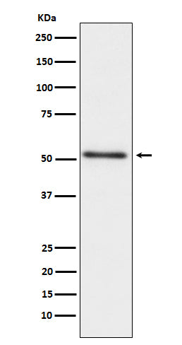 Prostatic Acid Phosphatase (14A5) Rabbit Monoclonal Antibody