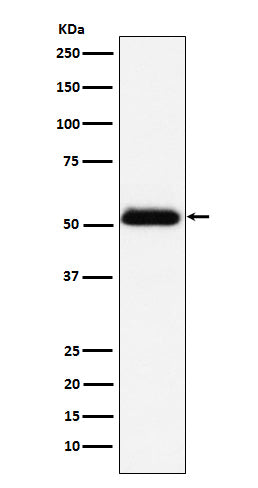 Prostatic Acid Phosphatase (18S11) Rabbit Monoclonal Antibody