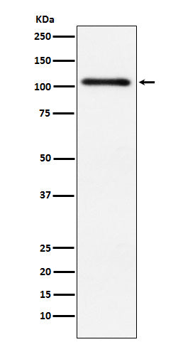 Protein Kinase D2 (11C16) Rabbit Monoclonal Antibody