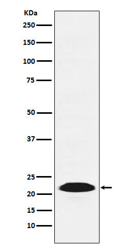 PSB9 / LMP2 (10V5) Rabbit Monoclonal Antibody