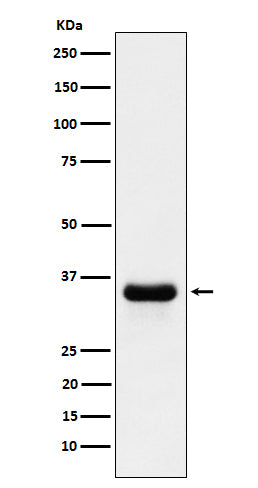 PSMD14 (10P7) Rabbit Monoclonal Antibody