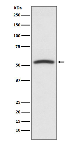 PTEN (16Q18) Rabbit Monoclonal Antibody