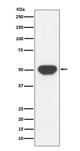PTP1B (13P19) Rabbit Monoclonal Antibody