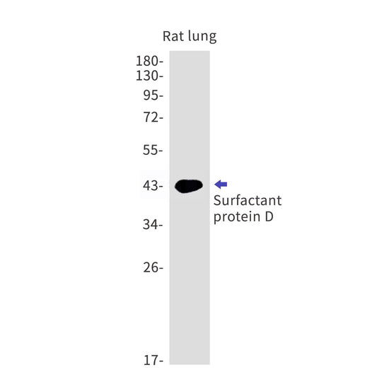 Pulmonary Surfactant Associated Protein D (13G17) Rabbit Monoclonal Antibody