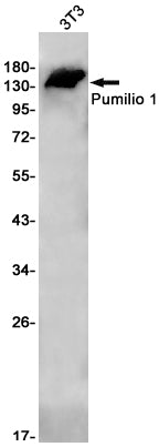 Pumilio 1 (7B2) Rabbit Monoclonal Antibody