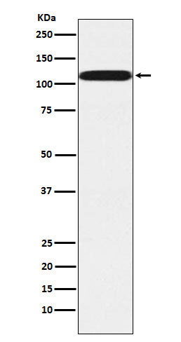 Pumilio 2 (18V6) Rabbit Monoclonal Antibody