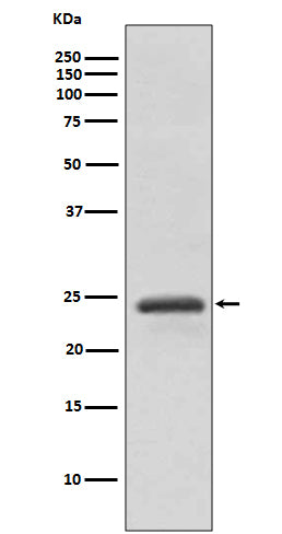 RAB11A (4O16) Rabbit Monoclonal Antibody