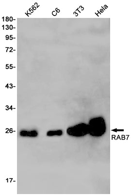 RAB7 (3N18) Rabbit Monoclonal Antibody