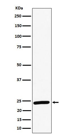 RAB8A (15Q17) Rabbit Monoclonal Antibody