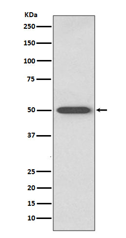 RAGE (1P3) Rabbit Monoclonal Antibody