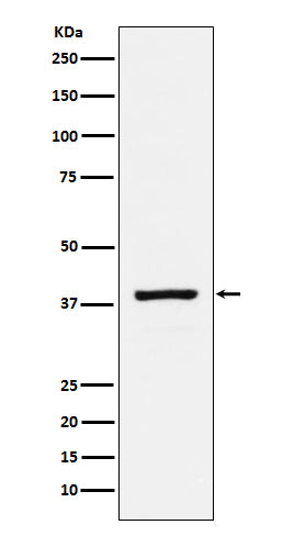 RASSF1 (19I9) Rabbit Monoclonal Antibody