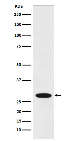 RCHY1 (11B14) Rabbit Monoclonal Antibody