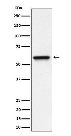 RGS6 (3A18) Rabbit Monoclonal Antibody