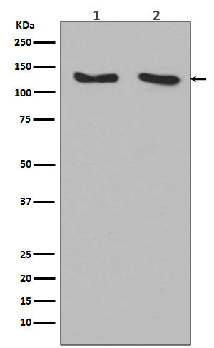 RNF20 (12E8) Rabbit Monoclonal Antibody