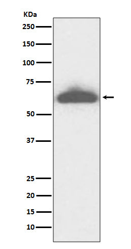 RPE65 (5T1) Rabbit Monoclonal Antibody