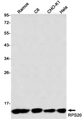 RPS20 (7B14) Rabbit Monoclonal Antibody