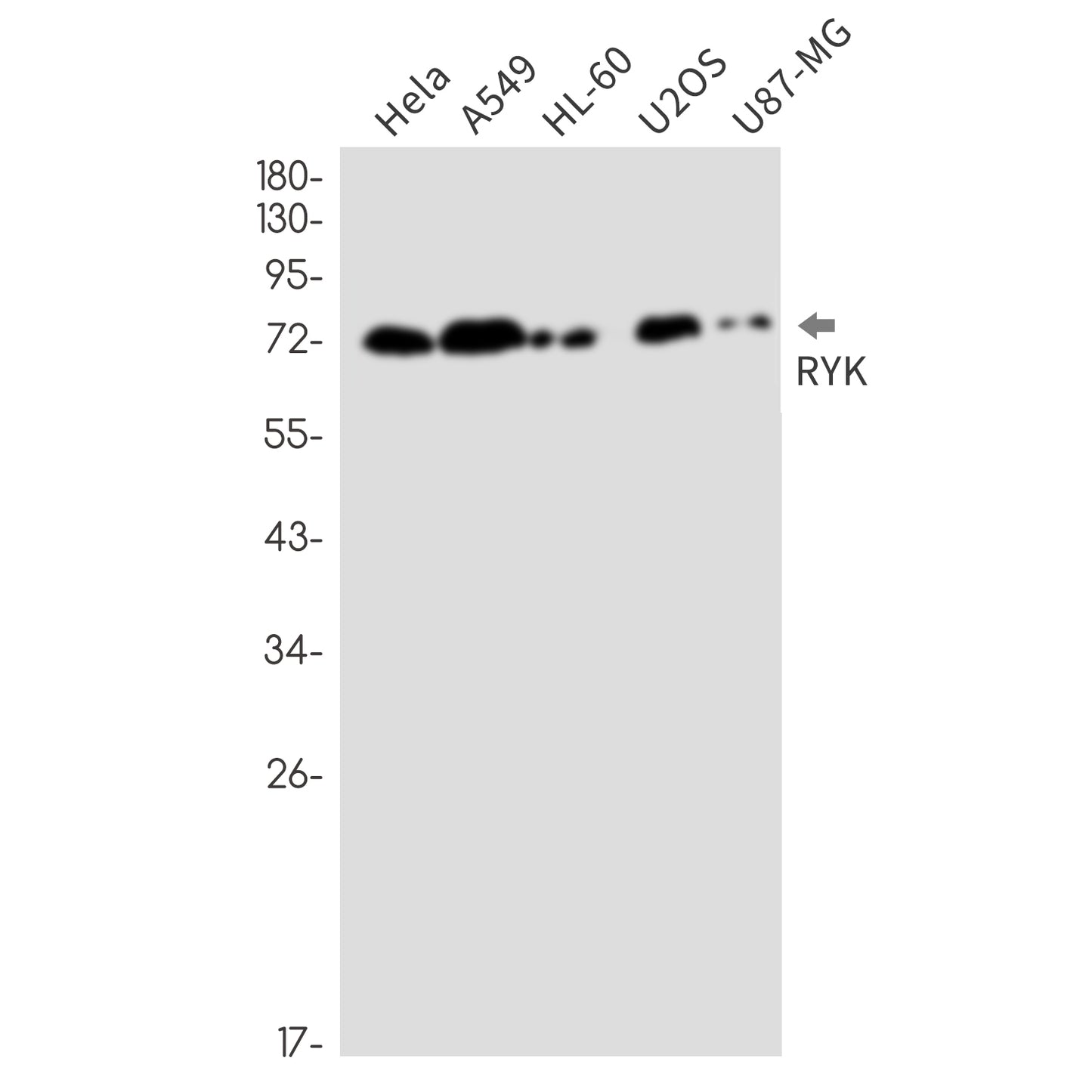RYK (13H7) Rabbit Monoclonal Antibody