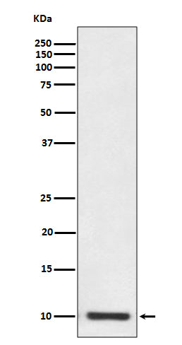 S100P (5R5) Rabbit Monoclonal Antibody