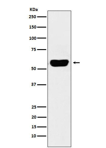 Salivary alpha amylase (5D14) Rabbit Monoclonal Antibody