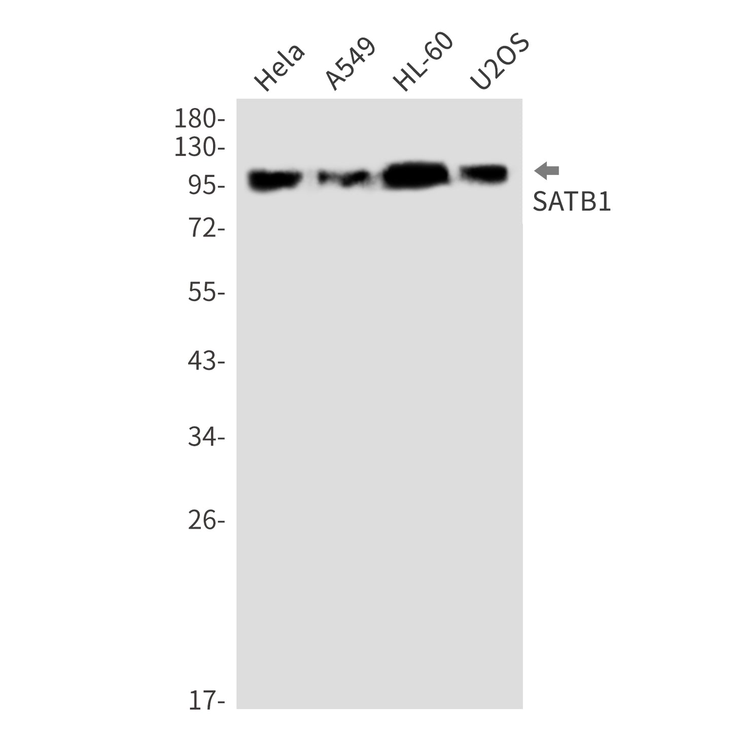 SATB1 (11U13) Rabbit Monoclonal Antibody