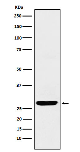 SCGN (9L19) Rabbit Monoclonal Antibody