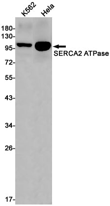SERCA2 (13M14) Rabbit Monoclonal Antibody