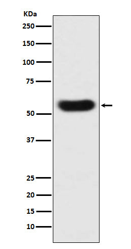 SERPINC1  (9T10) Rabbit Monoclonal Antibody