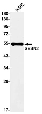SESN2 (9H4) Rabbit Monoclonal Antibody