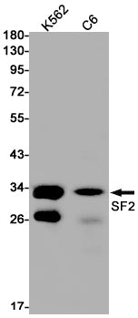 SF2 (5X2) Rabbit Monoclonal Antibody