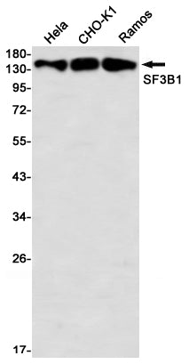 SF3B1 (13E17) Rabbit Monoclonal Antibody