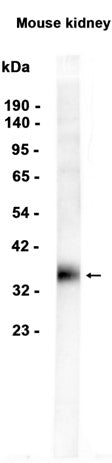 SFRP1 (1U15) Rabbit Monoclonal Antibody