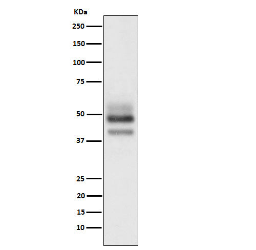 SKP2 (14Q16) Rabbit Monoclonal Antibody
