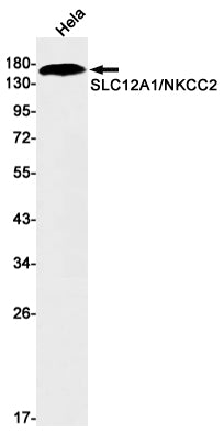 SLC12A1 / NKCC2 (7C8) Rabbit Monoclonal Antibody