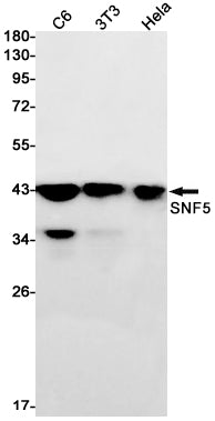 SNF5 (19H18) Rabbit Monoclonal Antibody