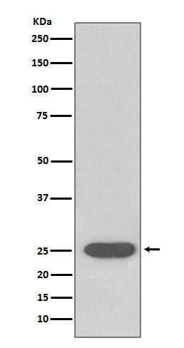 SOD2 (12J6) Rabbit Monoclonal Antibody