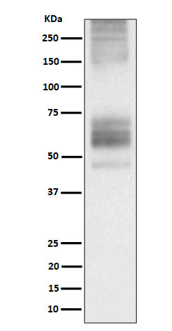 Somatostatin Receptor 1 (7R7) Rabbit Monoclonal Antibody