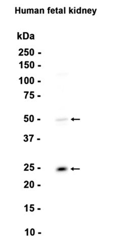 Sonic Hedgehog (15Y5) Rabbit Monoclonal Antibody