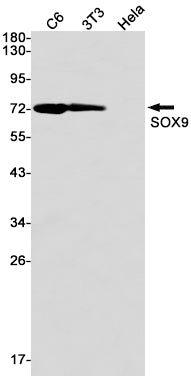 SOX9 (4K18) Rabbit Monoclonal Antibody