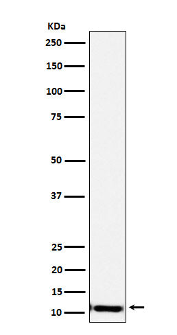 SPINK1 (15I10) Rabbit Monoclonal Antibody