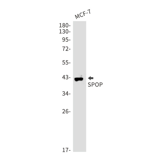 SPOP (2B14) Rabbit Monoclonal Antibody
