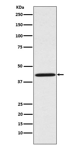 Sprouty 2 (4O5) Rabbit Monoclonal Antibody