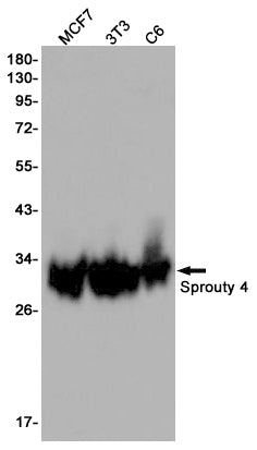 Sprouty 4 (11C12) Rabbit Monoclonal Antibody
