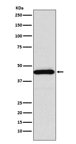 SSTR5 (13S14) Rabbit Monoclonal Antibody