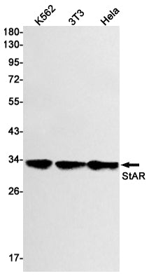 StAR (13D4) Rabbit Monoclonal Antibody