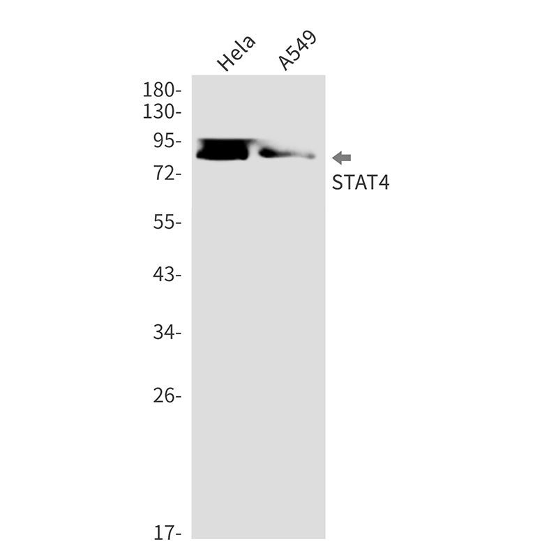STAT4 (6S16) Rabbit Monoclonal Antibody