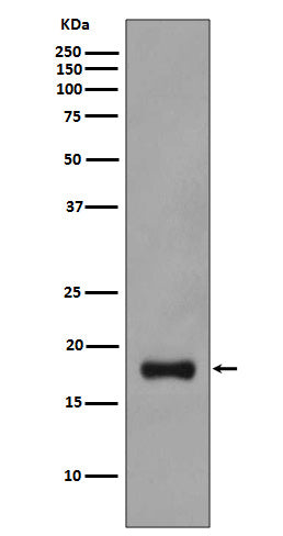 Stathmin 1 (10E8) Rabbit Monoclonal Antibody