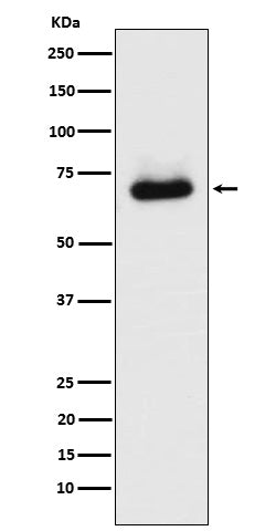 STK39 (18P19) Rabbit Monoclonal Antibody